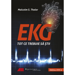 EKG - Tot ce trebuie să știi