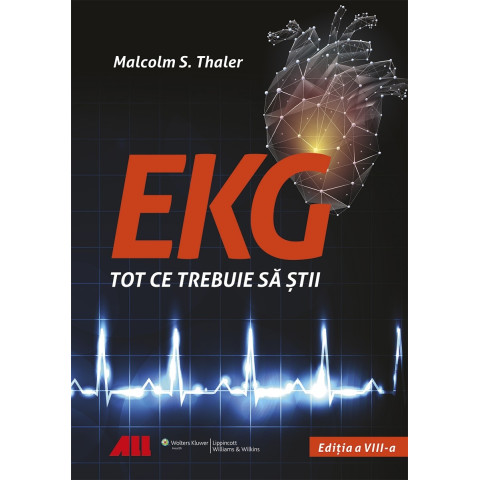 EKG - Tot ce trebuie să știi