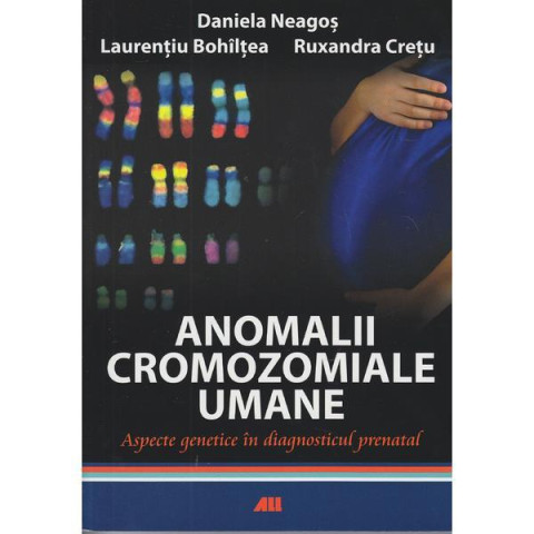 Anomalii cromozomiale umane