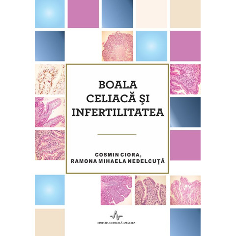 Boala celiacă și infertilitatea