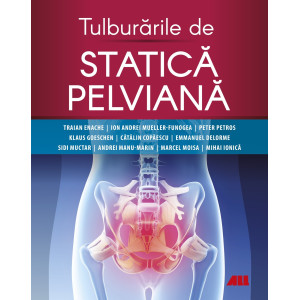 Tulburările de statică pelviană